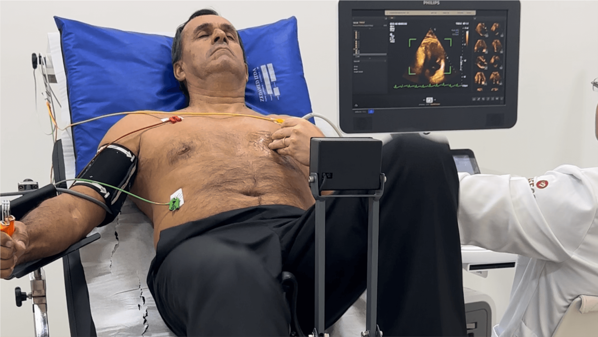 Leia mais sobre o artigo Para que serve o Ecocardiograma com estresse físico?